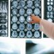medical professional looking at brain scans of a patient